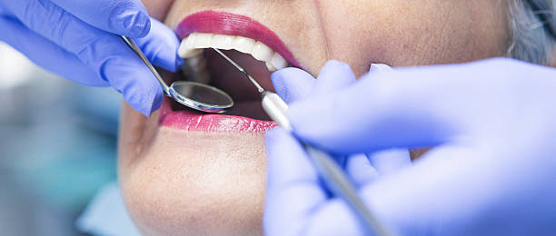 Best Emergency Dentist for Lost Fillings or Crowns in Torrington, WY